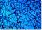 Awatar turquoise88