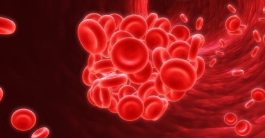 anemia